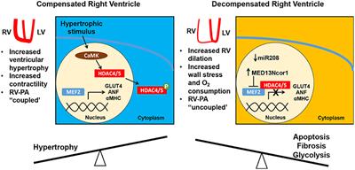 MEF2 and the Right Ventricle: From Development to Disease